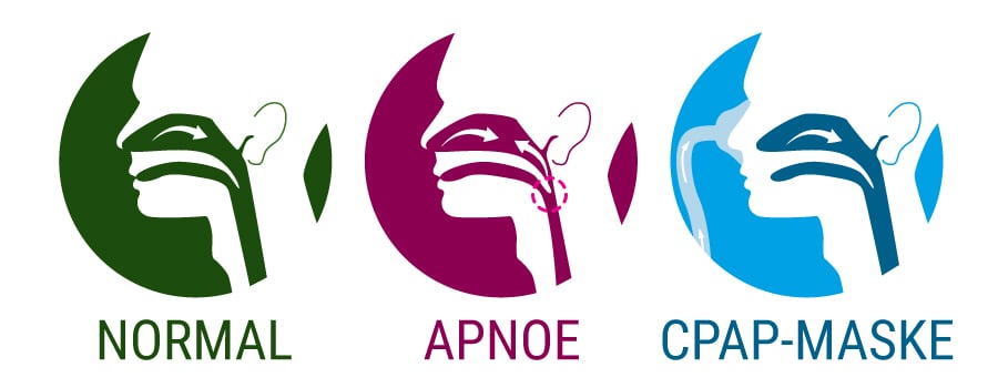 Apnoe Cpap-Maske