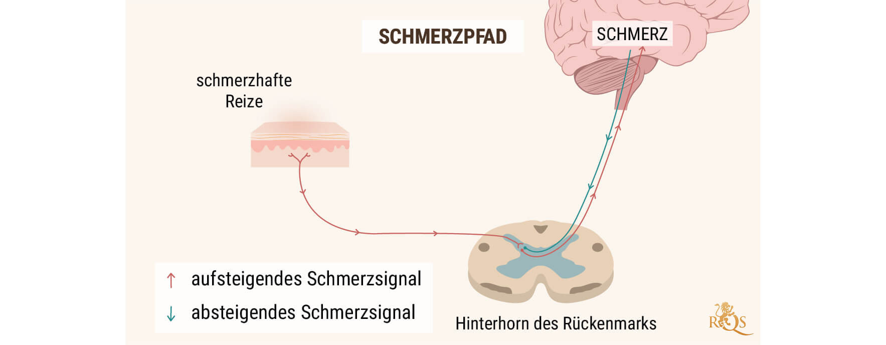 CBD-ÖL BEI SCHMERZEN