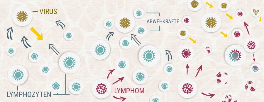 Lymphozyten Lymphom Cannabis