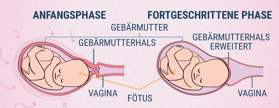 Uteruskontraktionen und CBD Uteruskontraktionen und CBD