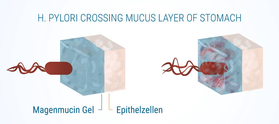 H-Pylori-Schleim-Schicht von Magen-Gastritis und Cannabis H-Pylori-Schleim-Schicht von Magen-Gastritis und Cannabis