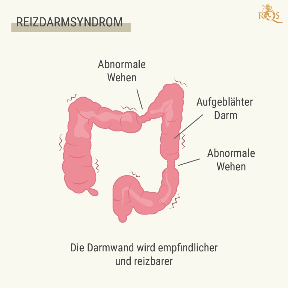 Was ist das RDS?