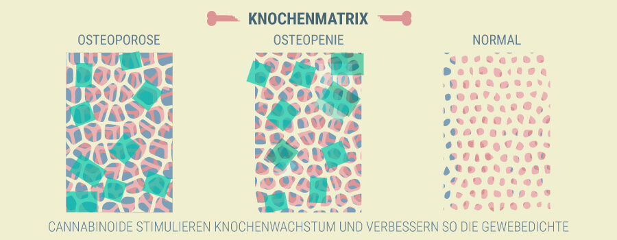Osteoporose CBD Osteoporose CBD