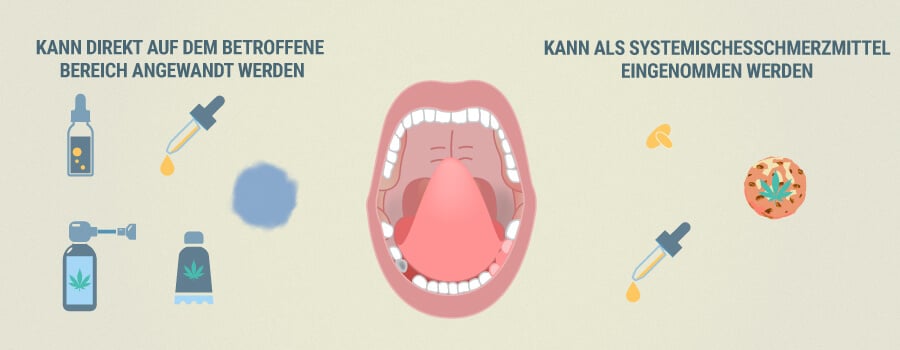 Wie Cbd Bei Zahnschmerzen Helfen Kann