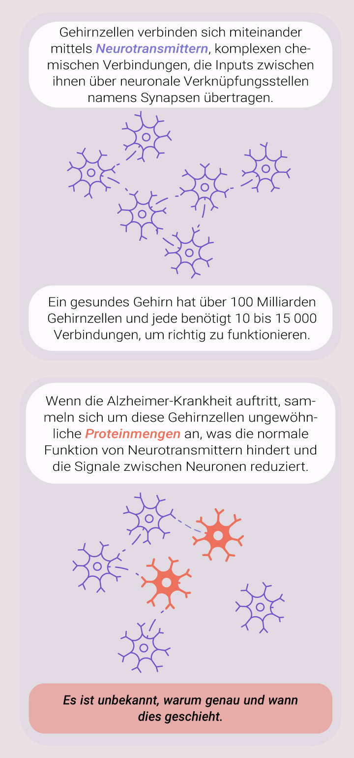 Was verursacht die Alzheimer-Krankheit?
