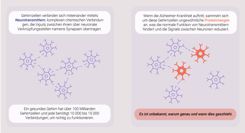 Was verursacht die Alzheimer-Krankheit? Was verursacht die Alzheimer-Krankheit?