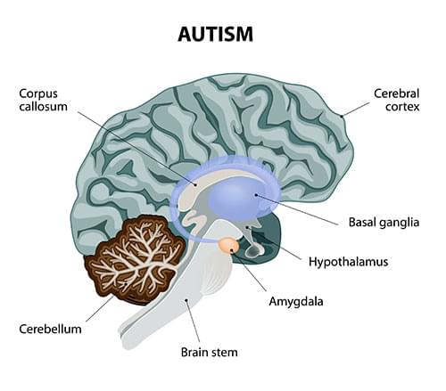 cannabis Autismus