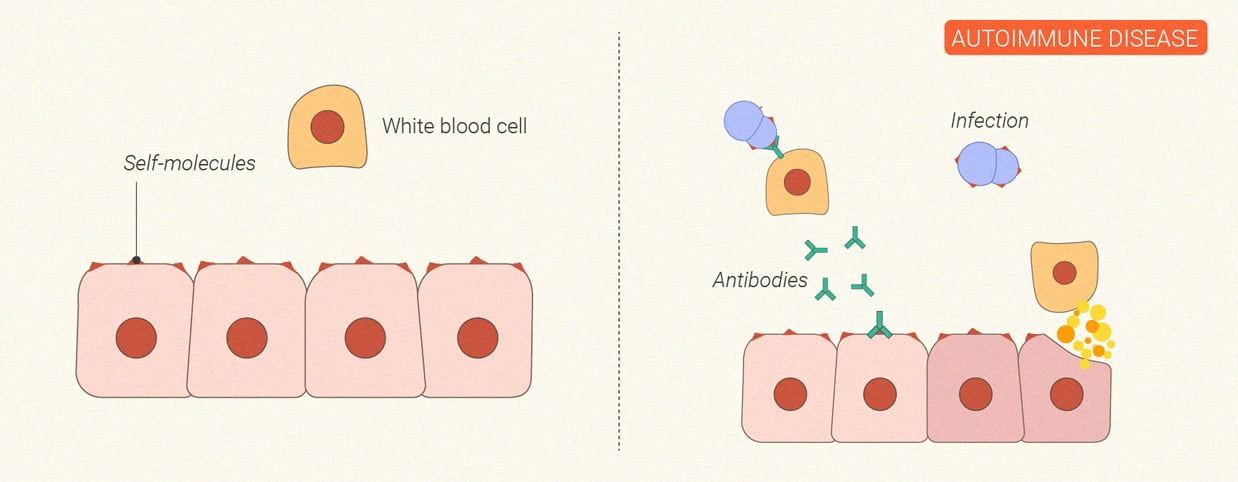 Wie wirkt sich Cannabis auf das Immunsystem aus?