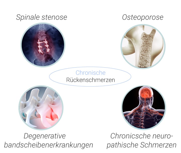 Häufige Ursachen und Arten von Rückenschmerzen