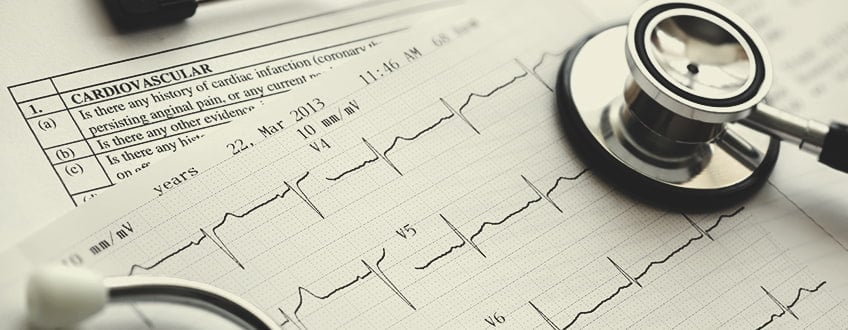 CBD und kardiovaskuläre Gesundheit CBD und kardiovaskuläre Gesundheit