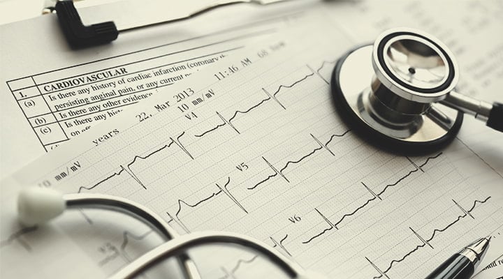 CBD und kardiovaskuläre Gesundheit CBD und kardiovaskuläre Gesundheit