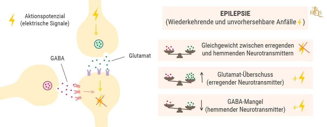 Die Wissenschaft hinter Anfällen