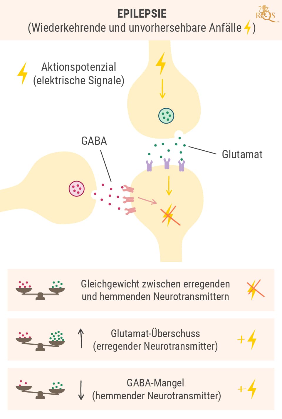 Die Wissenschaft hinter Anfällen