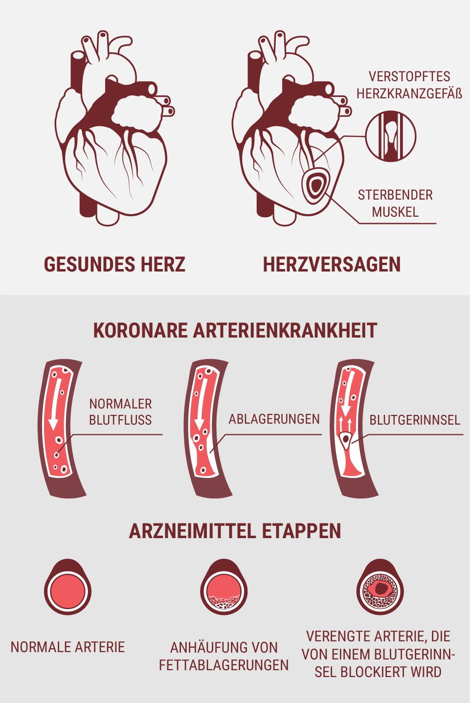 Sind Herz-Kreislauf-Erkrankungen und Herzerkrankung dasselbe?