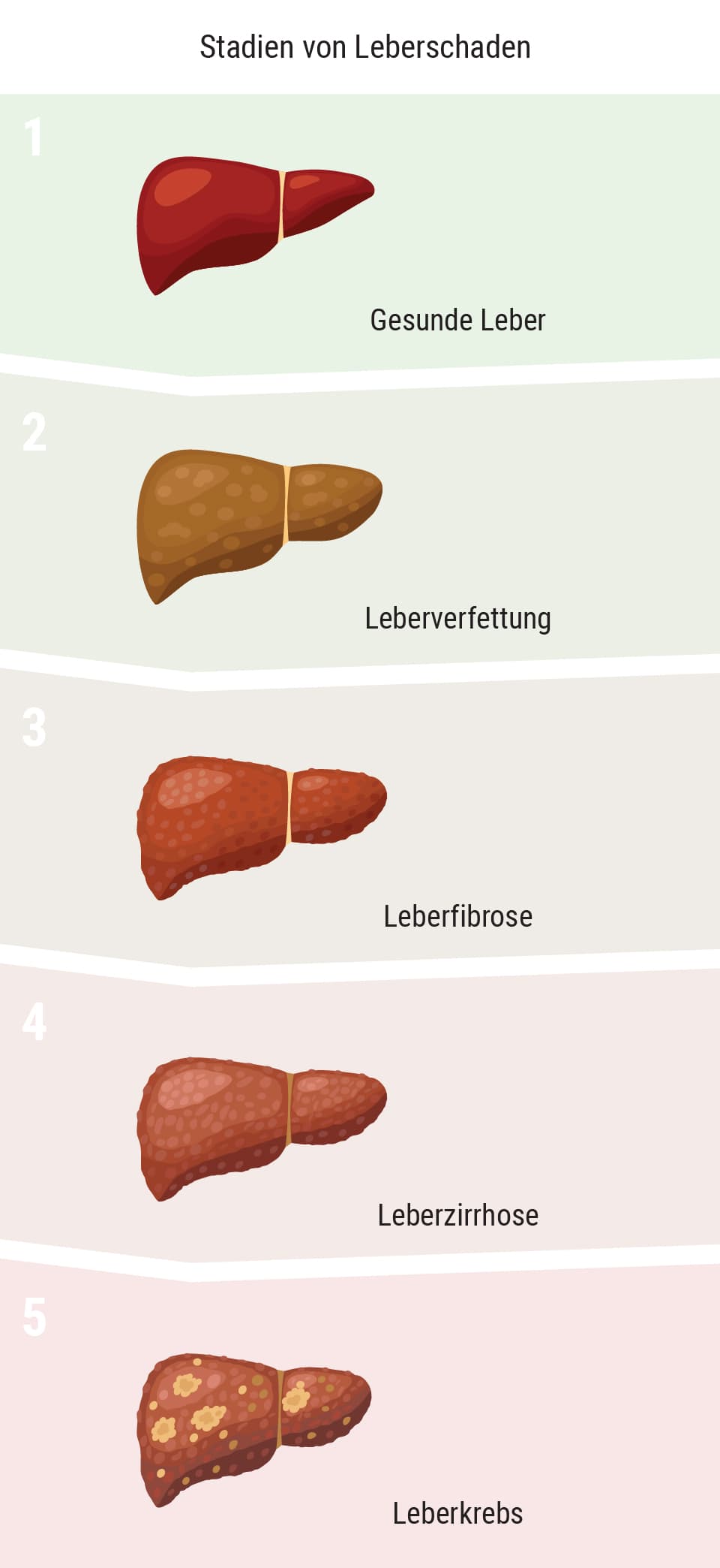 Beeinflusst Cannabis die Leber?