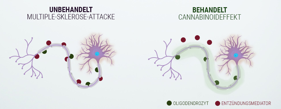 DER EINSATZ VON CANNABIS GEGEN MS DER EINSATZ VON CANNABIS GEGEN MS