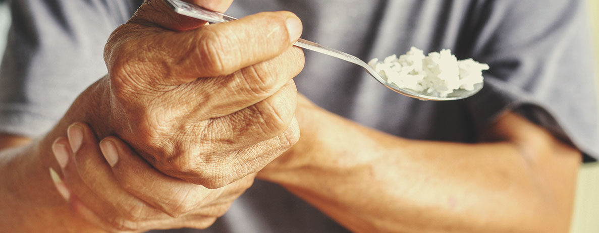 Wie sich Parkinson auf den Körper auswirkt Wie sich Parkinson auf den Körper auswirkt