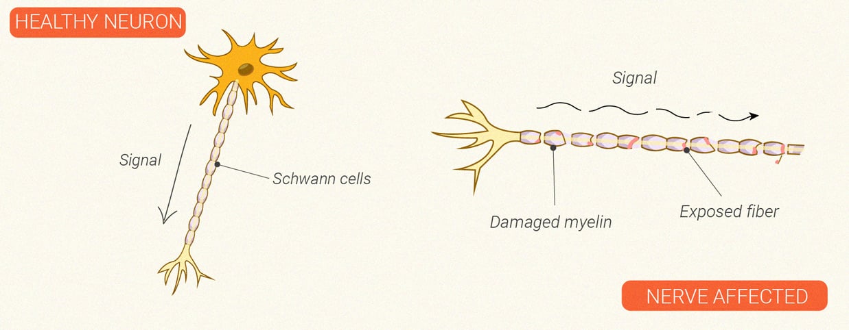 Wie wirkt sich Cannabis auf das Immunsystem aus?