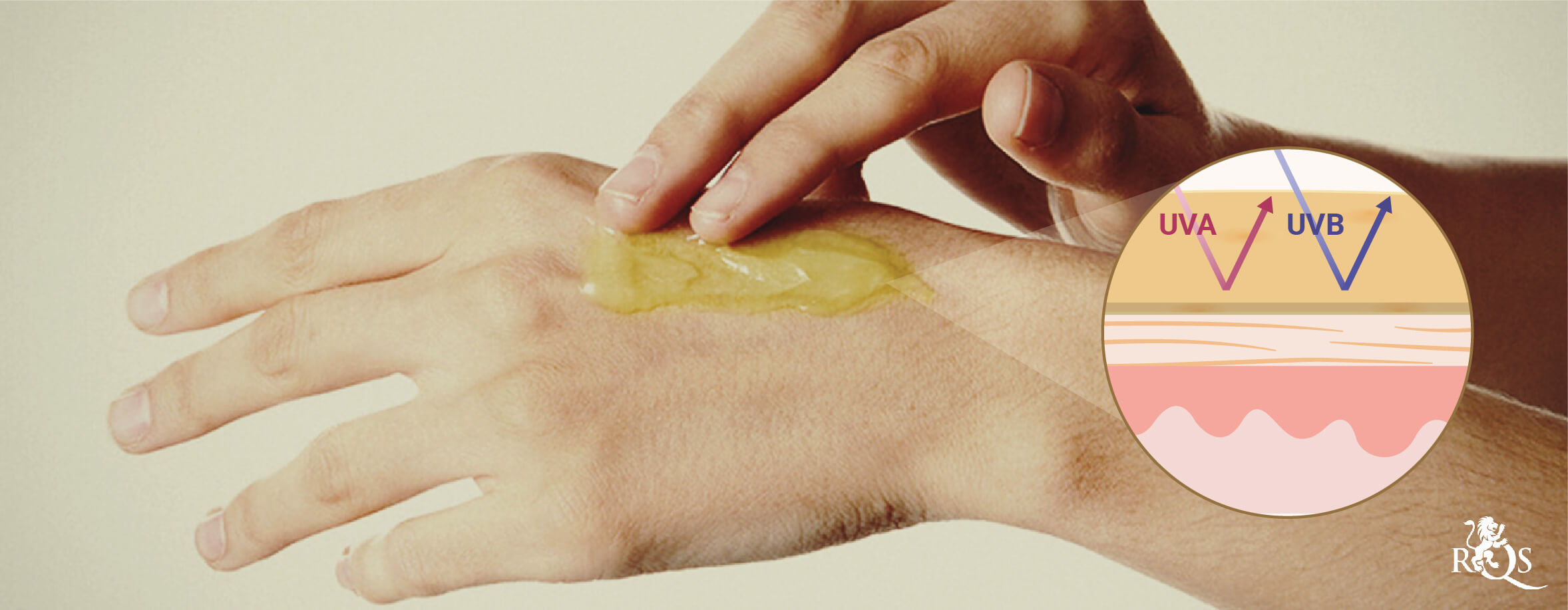 Hilft eine CBD-Lotion bei Sonnenbrand? Hilft eine CBD-Lotion bei Sonnenbrand?