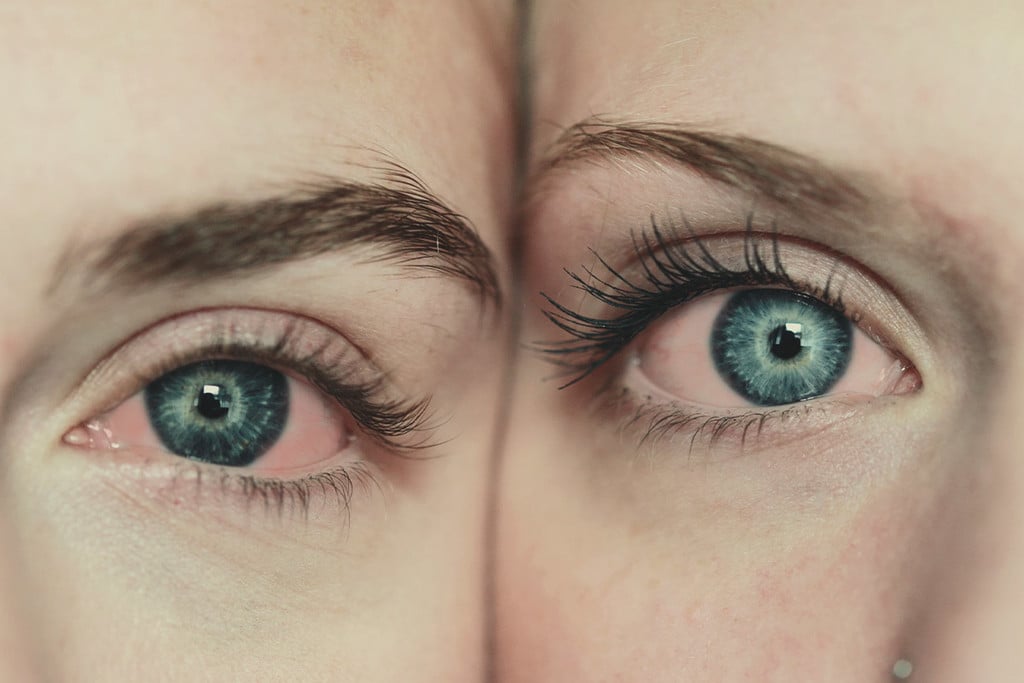 Warum Cannabis rote Augen verursacht