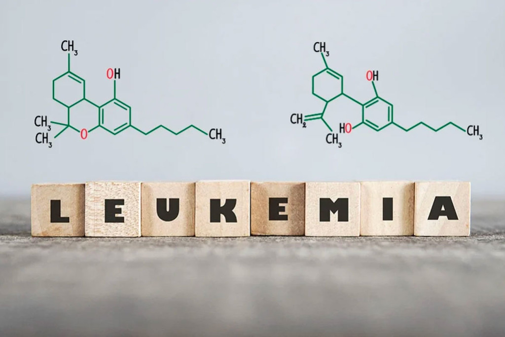 Die Rolle von Cannabis bei der Behandlung von Leukämie